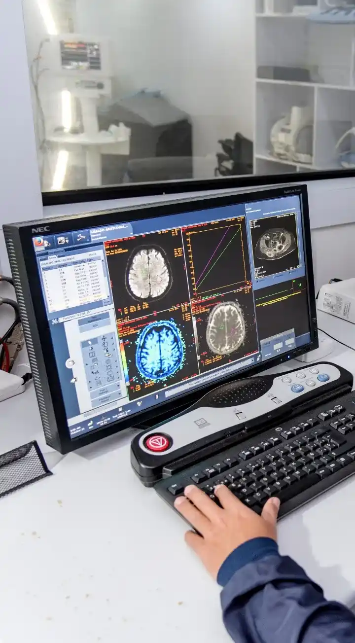 Servicio de neurocirugía en la Clínica Iberoamérica Barranquilla con equipos modernos